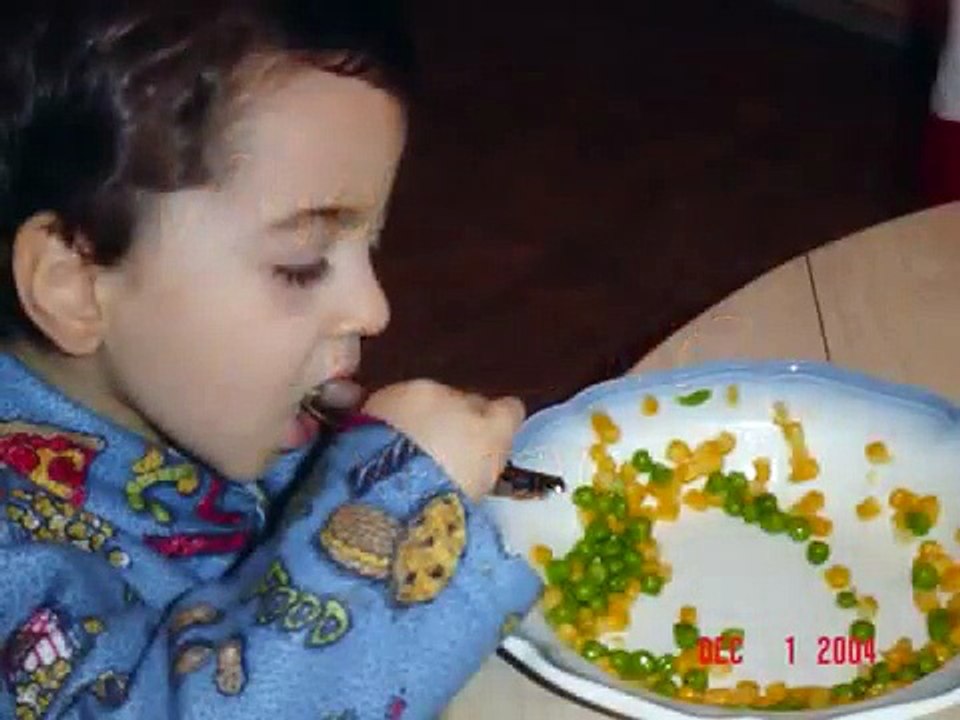 Prader-Willi Syndrome