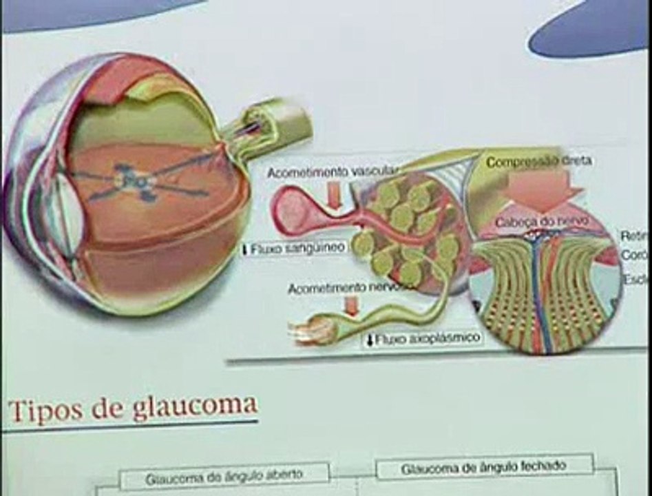 Córneas