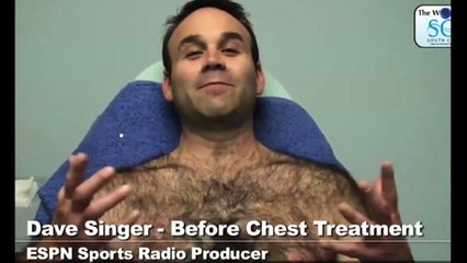 Dave Singer of Espn before and after laser hair removal pictures