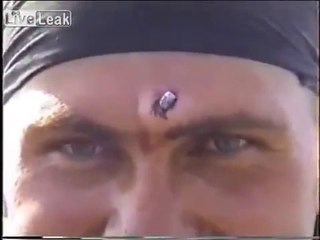 Video herunterladen: AK-47 bullet removed from Russian soldier's head