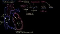 Khan Academy - Complications Post-Myocardial Infarction