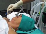 Ventilación e intubación con Fastrach