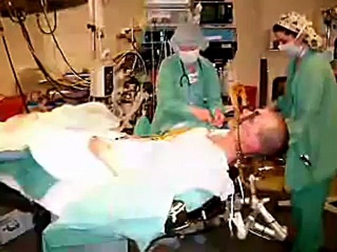 Tourettes syndrome and Deep brain stimulation