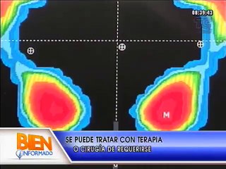 Bien Informado - ¿Cómo tratar deformidad en el talón?