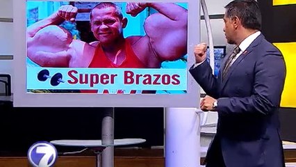 Brasileño aumenta sus músculos con inyecciones de aceite y alcohol