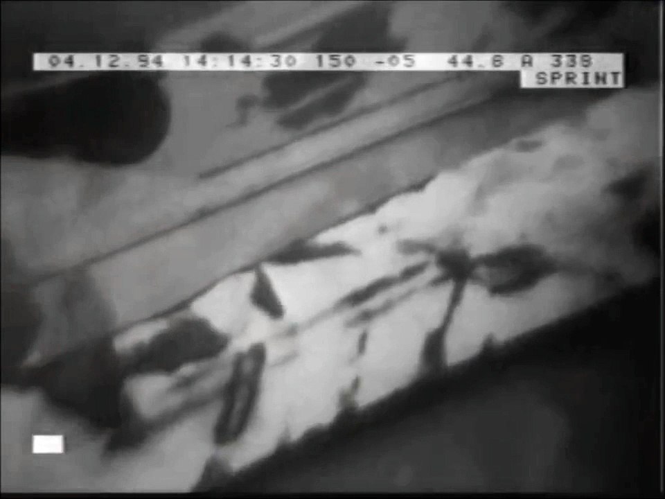 MS Estonia on film  - Underwater ROV footage ( Viking Sally, Silja Star, and Wasa King)