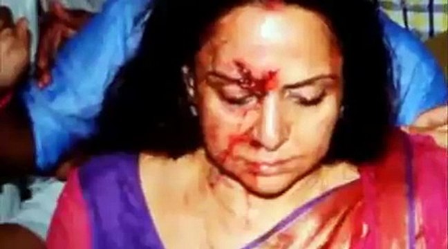 Hema Malini Car Accident: Child Killed, MP Has Minor Injuries