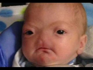 5 Most Amazing Miracle Babies