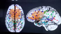 Brains Of Men And Women 'Wired Differently'