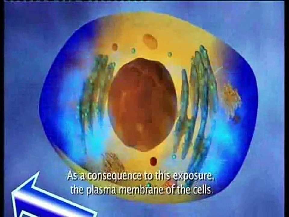 Elettrochemioterapia Rionero vulture_mpeg4.mp4