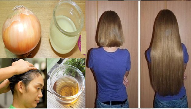 How to Grow Hair Fast using Onion Juice