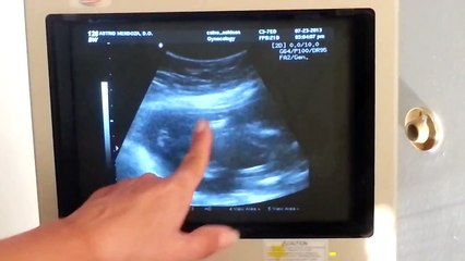 20 Week Ultrasound and Gender Reveal :D