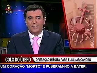 Cancro do Colo do Utero - Cirurgia