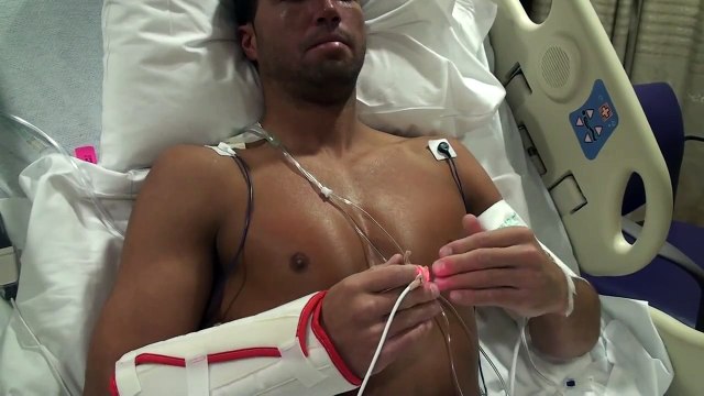 Pectus Excavatum -Clinton- Day #1 after Surgery Vid #3