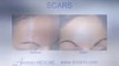 Before and After - Skin Problems Scars, Dark Circles, Birth Marks