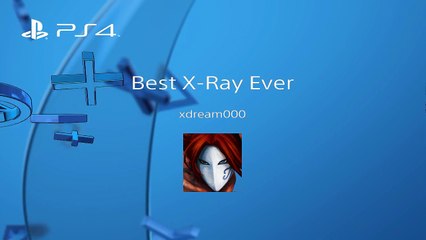 Best X-Ray complete with salt