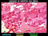 Musculação e Doenças Neuromusculares (Distrofia Muscular) - Coach Riccardo Rambo