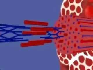 contraccion muscular