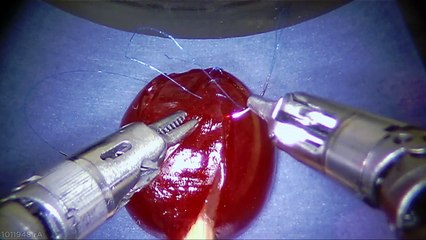 da Vinci Robot Stitches a Grape Back Together