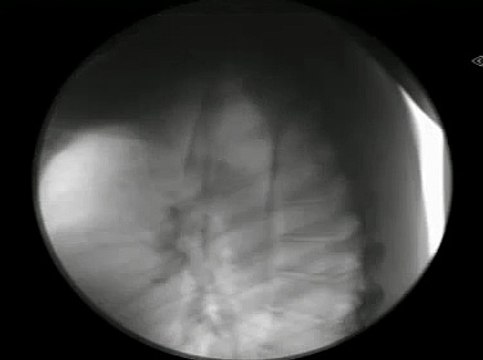 Moving X-ray INSIDE Sword Swallower Swallowing 7 swords on Stan Lee's Superhumans-aMc6-gJJWRA