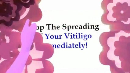 What Causes Vitiligo - The Secret Home Vitiligo Cure
