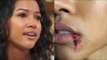 Did Chris Brown Give Karrueche Tran A Bloodied And Bruised Lip?- The Truth