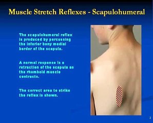 Chiropractic and the Scapulohumeral Reflex