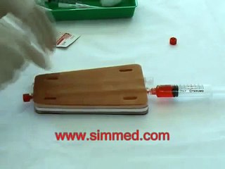 Venous Access with Cannula (Catheter - US)