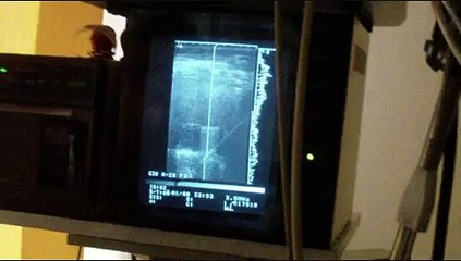 new (female) ultrasound exam