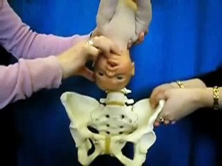 Occipito posterior lie. Deep transverse arrest