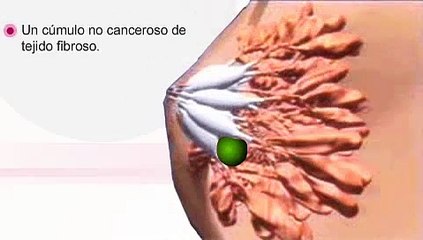 Autoexamen de Senos - video 2 de 6