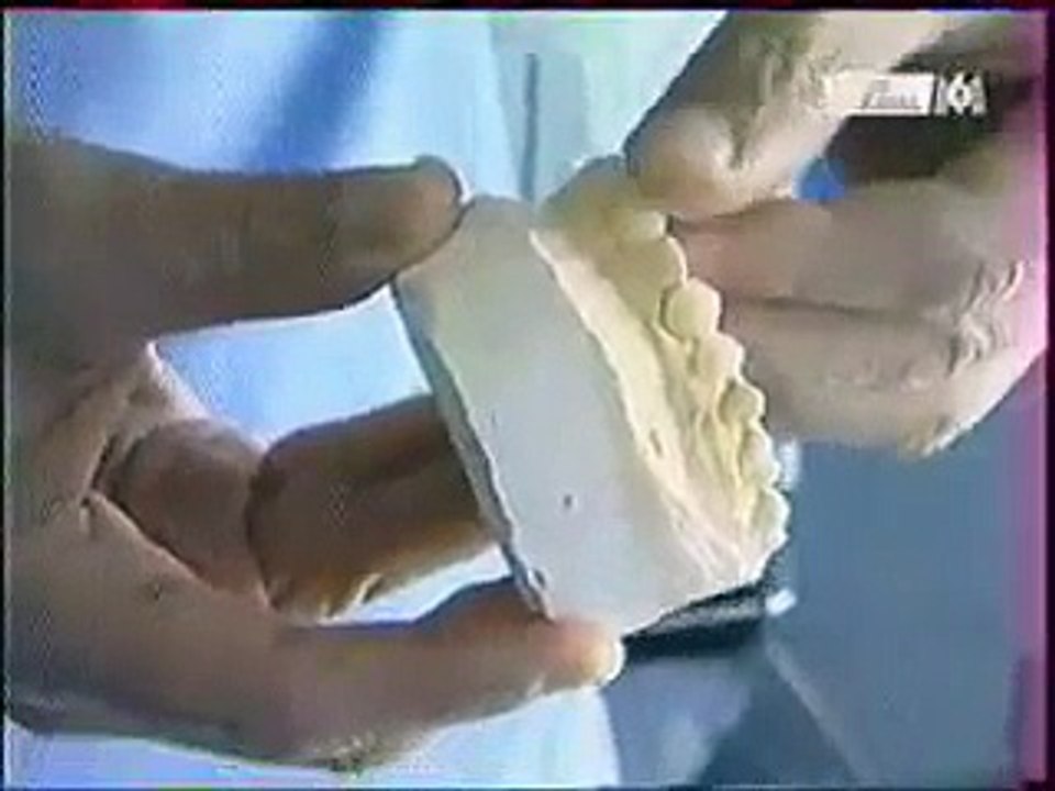 peur  dentiste  PHOBIE DENTAIRE stomatophobie clinique dentaire