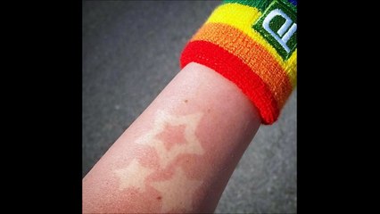 Coups de soleil artistiques - nouvelle mode à la con