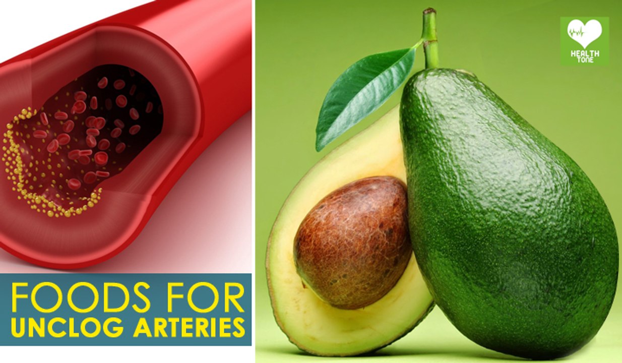 Arteries Unclog Foods | Best Health Food