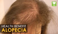 Alopecia Areata (Hair Loss) - Home Remedies | Health Tips