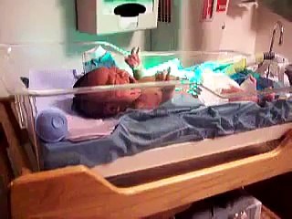 Nurse Changes Stephen's Diaper