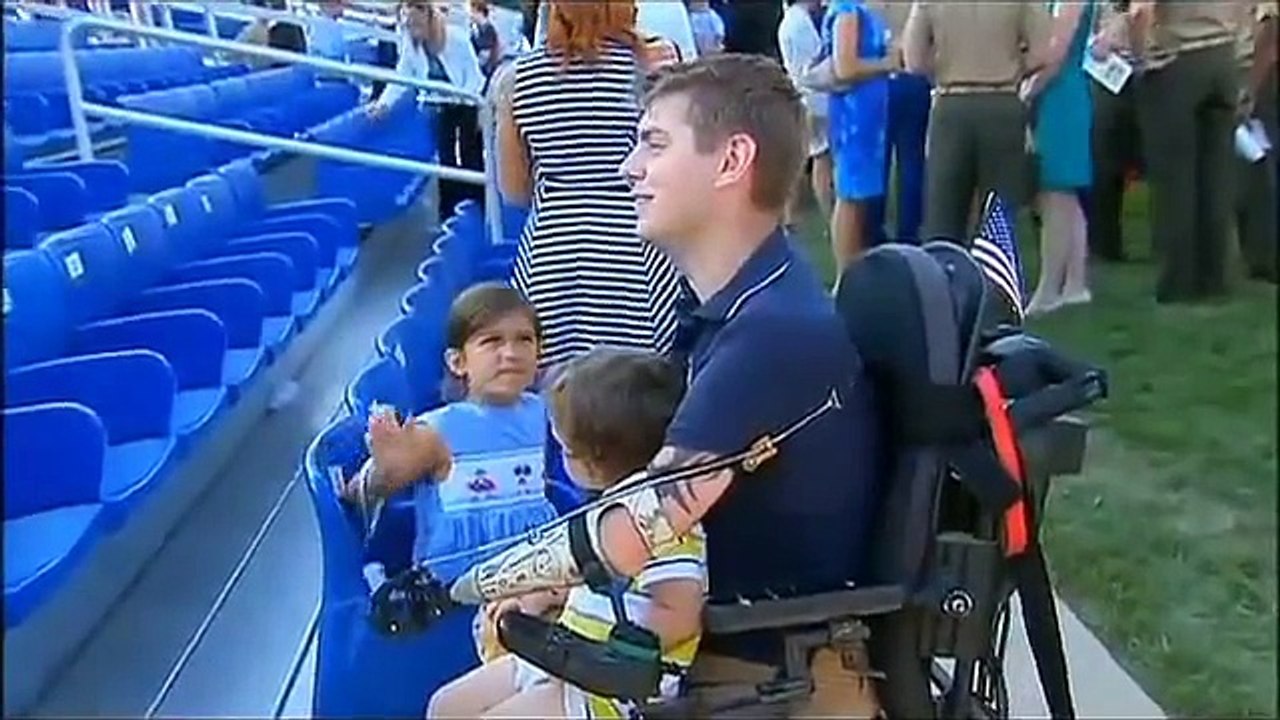 'Heart Of A Lion': Quadruple Amputee Afghanistan Vet Prepares For Arm Transplant