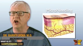Microneedling really helps your skin: Dr Barry Lycka video