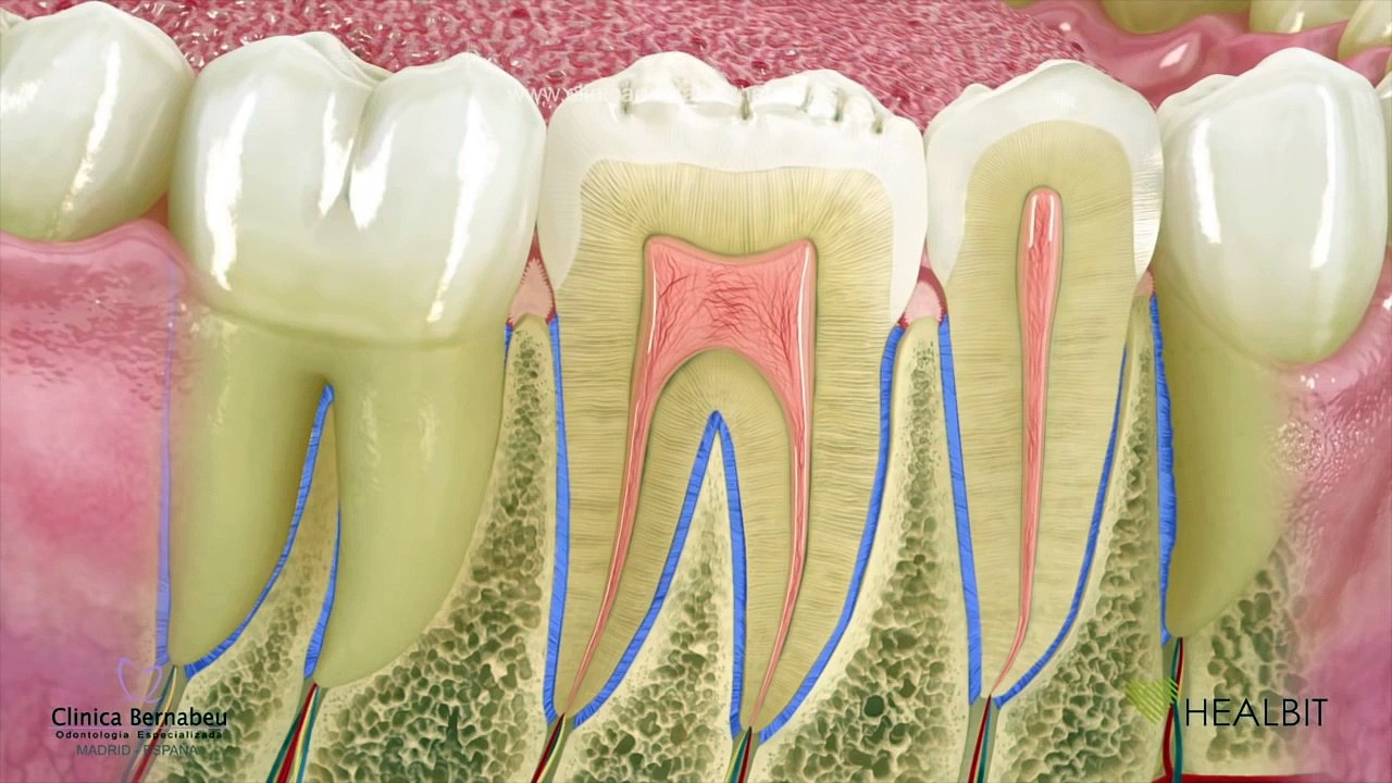 Periodoncia - gingivitis y periodontitis o "piorrea"