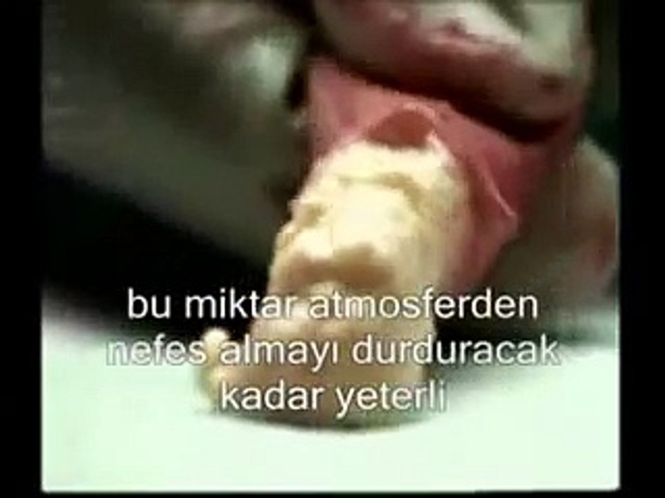 SİGARANIN ZARARLARI HİÇ BÖYLE GÖRMEDİNİZ http://www.kumbag.net kumbağ