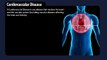 Preventing Heart Disease - Statistics, Risk Factors and Prevention Guidelines Video