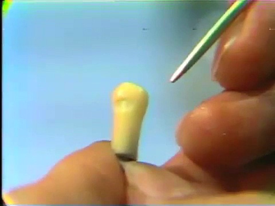 Dental Anatomy: Waxing a Mandibular Bicuspid