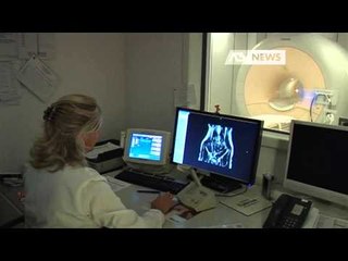 MIGLIORANO LE LISTE D'ATTESA