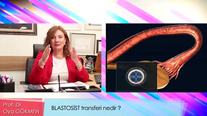 Prof. Dr. Oya Gökmen - Blastosist transferi nedir?