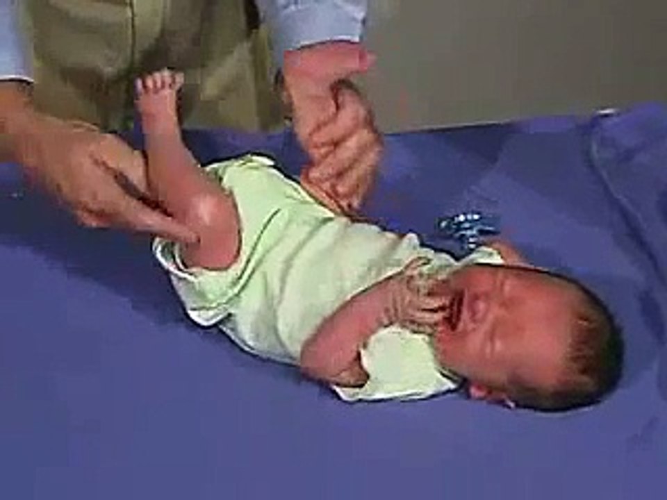 physical exam -Newborn Normal: Cranial Nerves