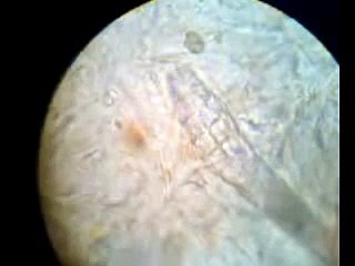 Demodex canis