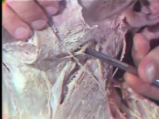 Dissection: Superficial Cervical Region and Posterior Triangle of Neck