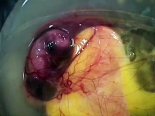 Mucizeye Şahit Olmak İster misiniz