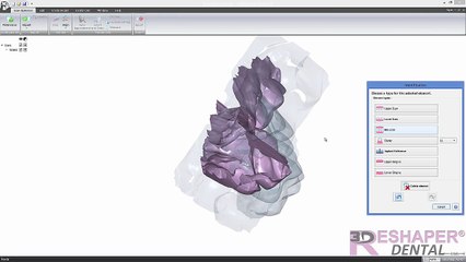 3DReshaper Dental Initial - STL Optimizer (10-2014)
