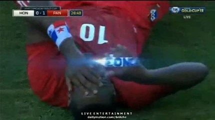 Tejada gets Injured after being kicked on EYE !! Honduras v. Panama 0-1 Gold Cup 2015